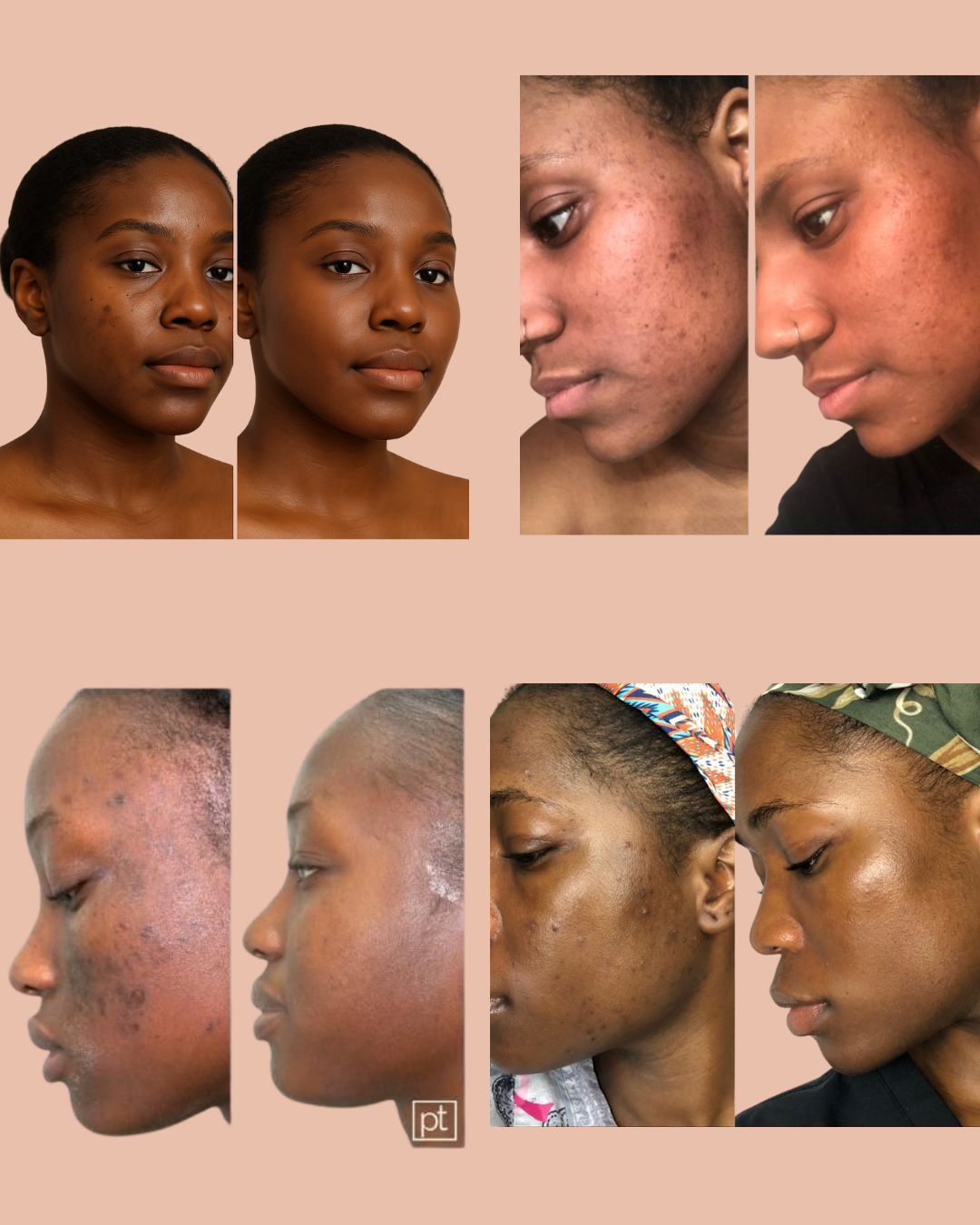 Soin Éclat Naturel – Curcuma & Acide Kojique | Curalyse